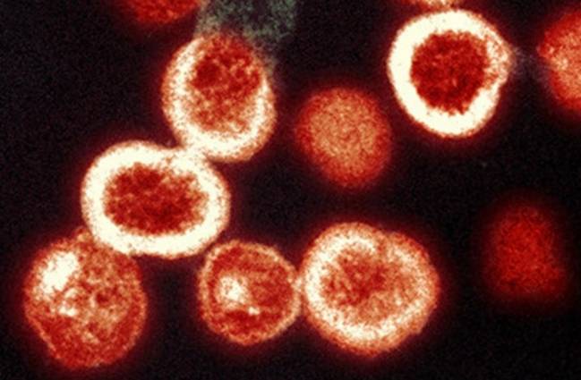 ‘Vibrio vulnificus’, la bacteria mal llamada ‘carnívora’, supone un riesgo muy bajo para la población general