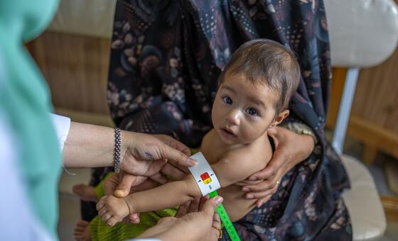 La desnutrición infantil alcanza niveles críticos en 12 provincias de Afganistán