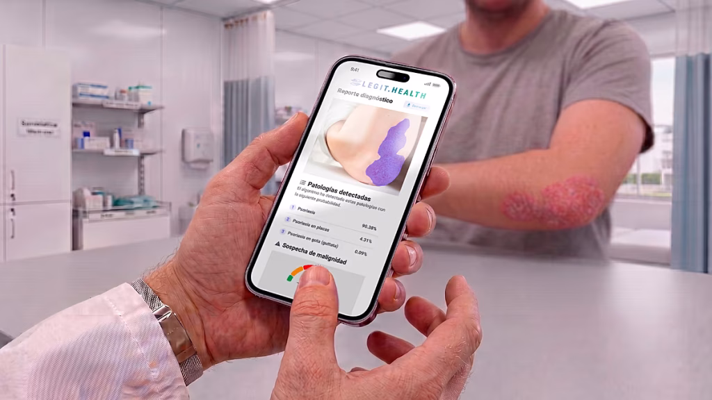La inteligencia artificial nacida en España que mejora el diagnóstico dermatológico