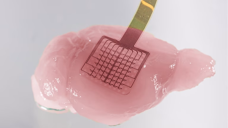 El grafeno abre una nueva vía para detectar daños cerebrales tras un ictus: así funciona