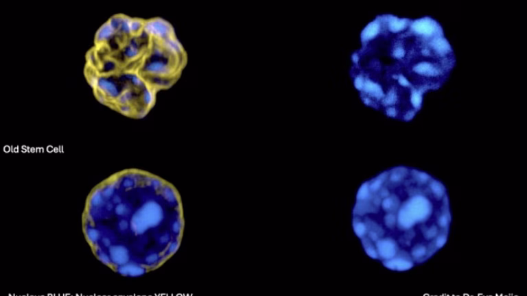 Un equipo científico de Barcelona crea una IA que detecta el envejecimiento en las células madre de la sangre